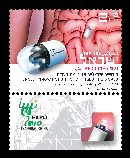 Stamp:Medicine - Medical Devices (Israeli Innovations that Changed the World - Expo 2010 Shanghai, China), designer:Meir Eshel 04/2010